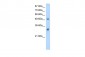 DDX19B antibody - C-terminal region